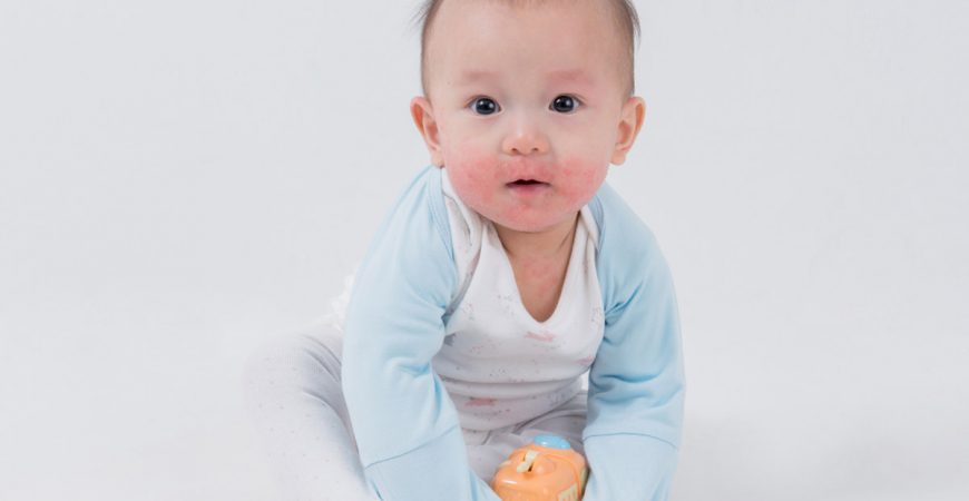 Breathe a Sigh of Relief: Little Warriors Protects Your Baby’s Eczema-Prone Skin